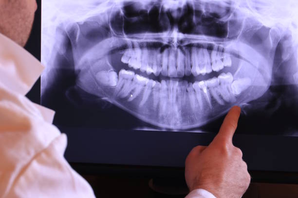 Best Emergency Cosmetic Dentistry (e.g., broken veneers) in Vineyard, UT