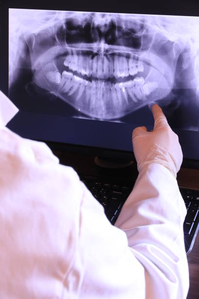 Best Broken or Chipped Tooth Repair in Vineyard, UT